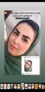 نظر کاشت ابرو (دکتر محمود جعفری)