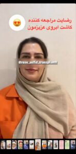 نظر کاشت ابرو (دکتر محمود جعفری)