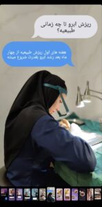 نمونه کاشت مو (كلينيك كاشت مو و ابرو پديده)