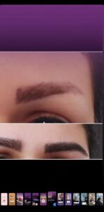 نمونه کاشت مو (كلينيك كاشت مو و ابرو پديده)