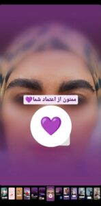 نمونه کاشت مو (كلينيك كاشت مو و ابرو پديده)