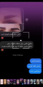 رضایت کاشت مو (كلينيك كاشت مو و ابرو پديده)