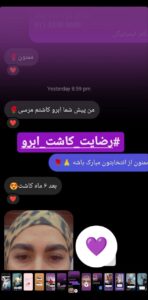 رضایت کاشت ابرو (كلينيك كاشت مو و ابرو پديده)