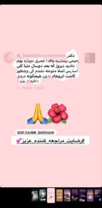 نمونه کاشت مو (كلينيك كاشت مو و ابرو پديده)