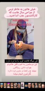 نمونه کاشت مو (كلينيك كاشت مو آرا)