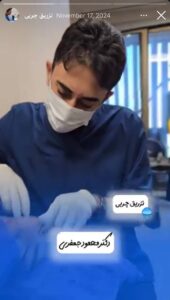 نمونه کار تزریق چربی کلینیک رز سیفد در ساری
