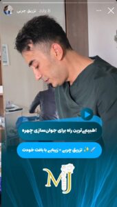 نمونه کار تزریق چربی کلینیک رز سیفد در ساری