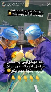 نمونه کار اتوپلاستی (جراحی گوش) دکتر جعفری در ساری