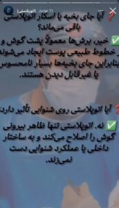 هایلایت اینستاگرام اتوپلاستی دکتر اعتماد در ساری