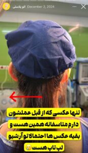 نمونه کار اتوپلاستی (جراحی گوش) دکتر محرابی در ساری