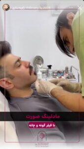 نمونه کار زاویه سازی صورت کلینیک الگانت