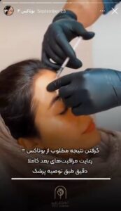 نمونه کار زاویه سازی صورت کلینیک الگانت