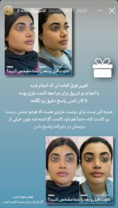 نمونه کار زاویه سازی صورت دکتر اسلامی در ساری