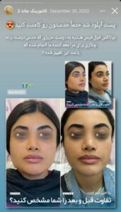 نمونه کار زاویه سازی صورت دکتر اسلامی در ساری