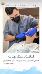 نمونه کار زاویه سازی صورت دکتر اسلامی در ساری