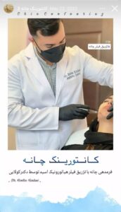 نمونه کار زاویه سازی صورت دکتر اسلامی در ساری