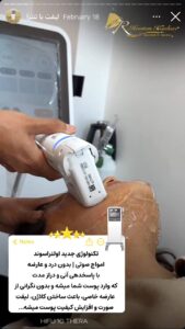 نمونه کار زاویه سازی صورت دکتر اسلامی در ساری