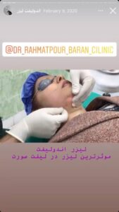 نمونه کار زاویه سازی صورت کلینیک باران در ساری