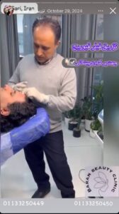 نمونه کار زاویه سازی صورت کلینیک باران در ساری