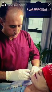 نمونه کار زاویه سازی صورت کلینیک باران در ساری