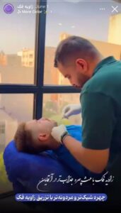 نمونه کار زاویه سازی صورت کلینیک کاژه