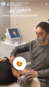 نمونه کار زاویه سازی صورت کلینیک رز سفید در ساری