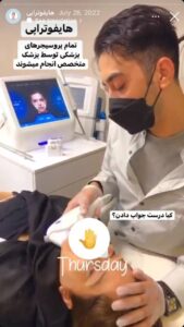 نمونه کار زاویه سازی صورت کلینیک رز سفید در ساری