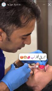 نمونه کار زاویه سازی صورت کلینیک رز سفید در ساری