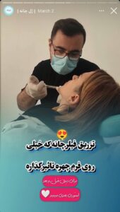 نمونه کار زاویه سازی صورت کلینیک برنا در ساری