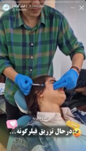 نمونه کار زاویه سازی صورت کلینیک برنا در ساری