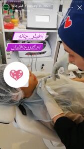 نمونه کار زاویه سازی صورت دکتر رجا قلیان در ساری