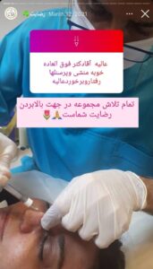 نمونه کار زاویه سازی صورت کلینیک مه رخ در ساری