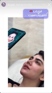 نمونه کار زاویه سازی صورت دکتر احتشامی در ساری