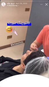 نمونه کار زاویه سازی صورت دکتر احتشامی در ساری