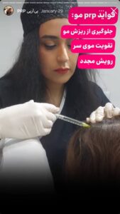 نمونه کار پی آر پی کلینیک الگانت در ساری