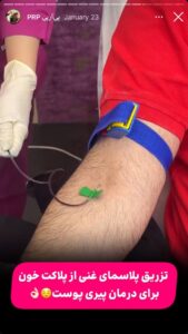 نمونه کار پی آر پی کلینیک الگانت در ساری