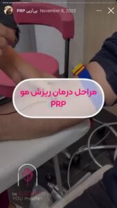 نمونه کار پی آر پی کلینیک الگانت در ساری