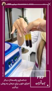 نمونه کار پی آر پی کلینیک الگانت در ساری