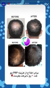 نمونه کار پی آر پی دکتر خوش نظر در ساری