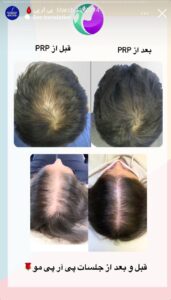 نمونه کار پی آر پی دکتر خوش نظر در ساری