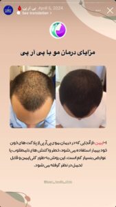 نمونه کار پی آر پی دکتر خوش نظر در ساری