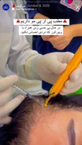 نمونه کار پی آر پی دکتر خوش نظر در ساری