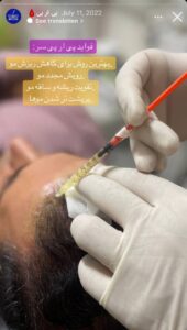 نمونه کار پی آر پی دکتر خوش نظر در ساری