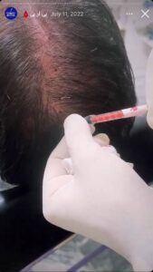 نمونه کار پی آر پی دکتر خوش نظر در ساری