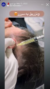 نمونه کار پی آر پی دکتر خوش نظر در ساری