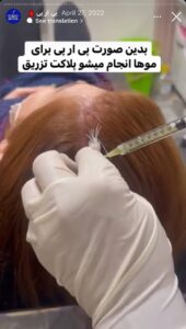 نمونه کار پی آر پی دکتر خوش نظر در ساری