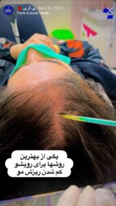 نمونه کار پی آر پی دکتر خوش نظر در ساری