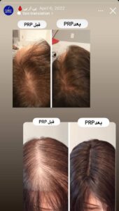 نمونه کار پی آر پی دکتر خوش نظر در ساری