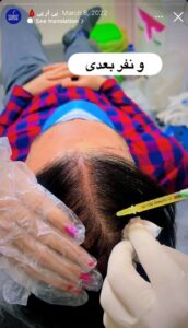 نمونه کار پی آر پی دکتر خوش نظر در ساری