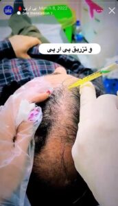 نمونه کار پی آر پی دکتر خوش نظر در ساری